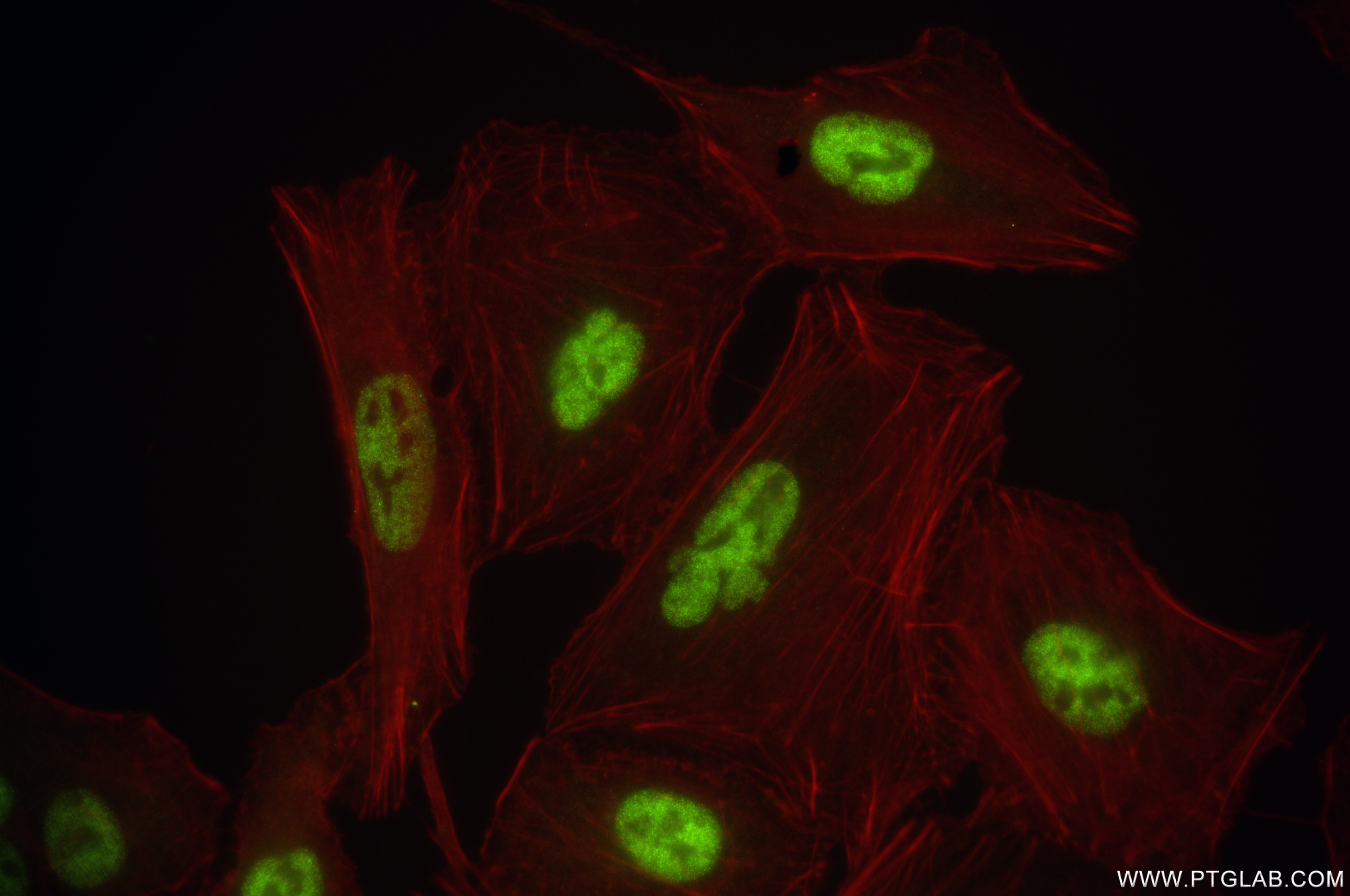 Immunofluorescence (IF) / fluorescent staining of A549 cells using MDMX/MDM4 Recombinant antibody (84534-6-RR)