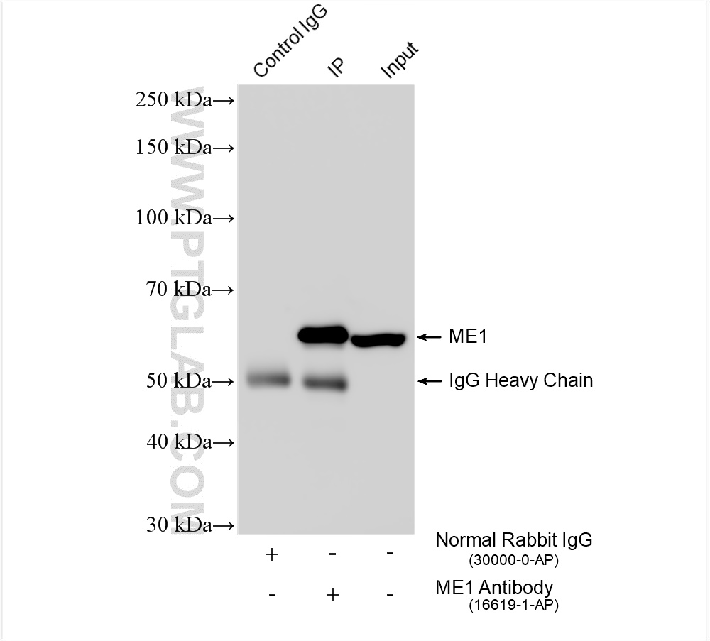 Immunoprecipitation (IP) experiment of mouse liver tissue using ME1 Polyclonal antibody (16619-1-AP)