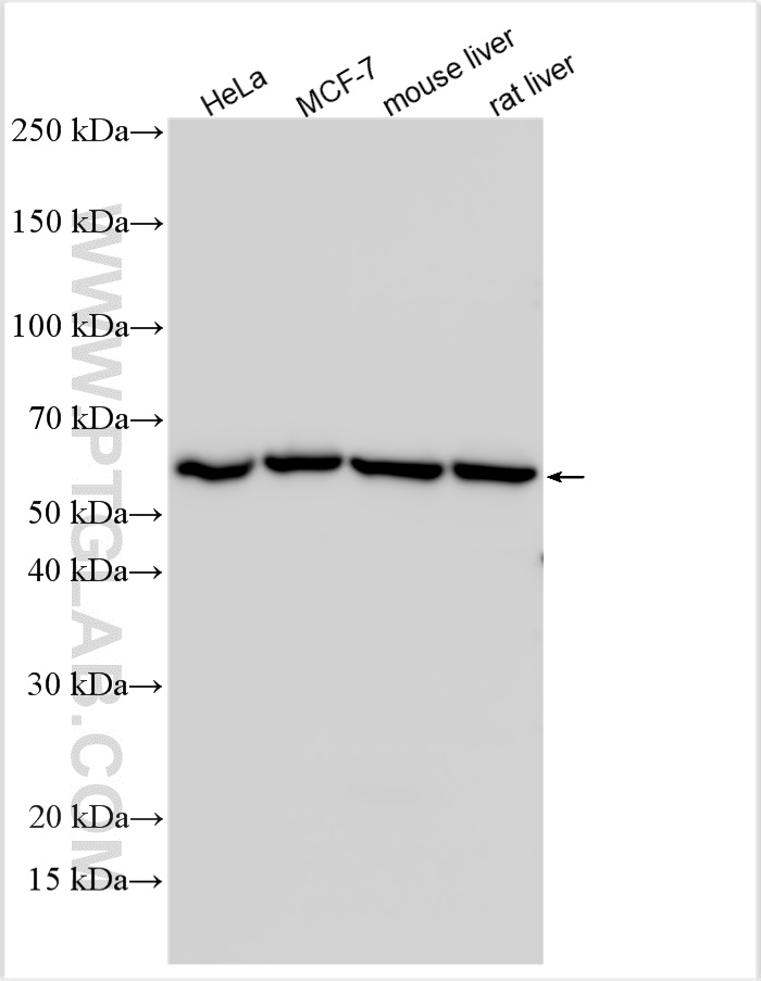 Western Blot (WB) analysis of various lysates using ME1 Polyclonal antibody (16619-1-AP)