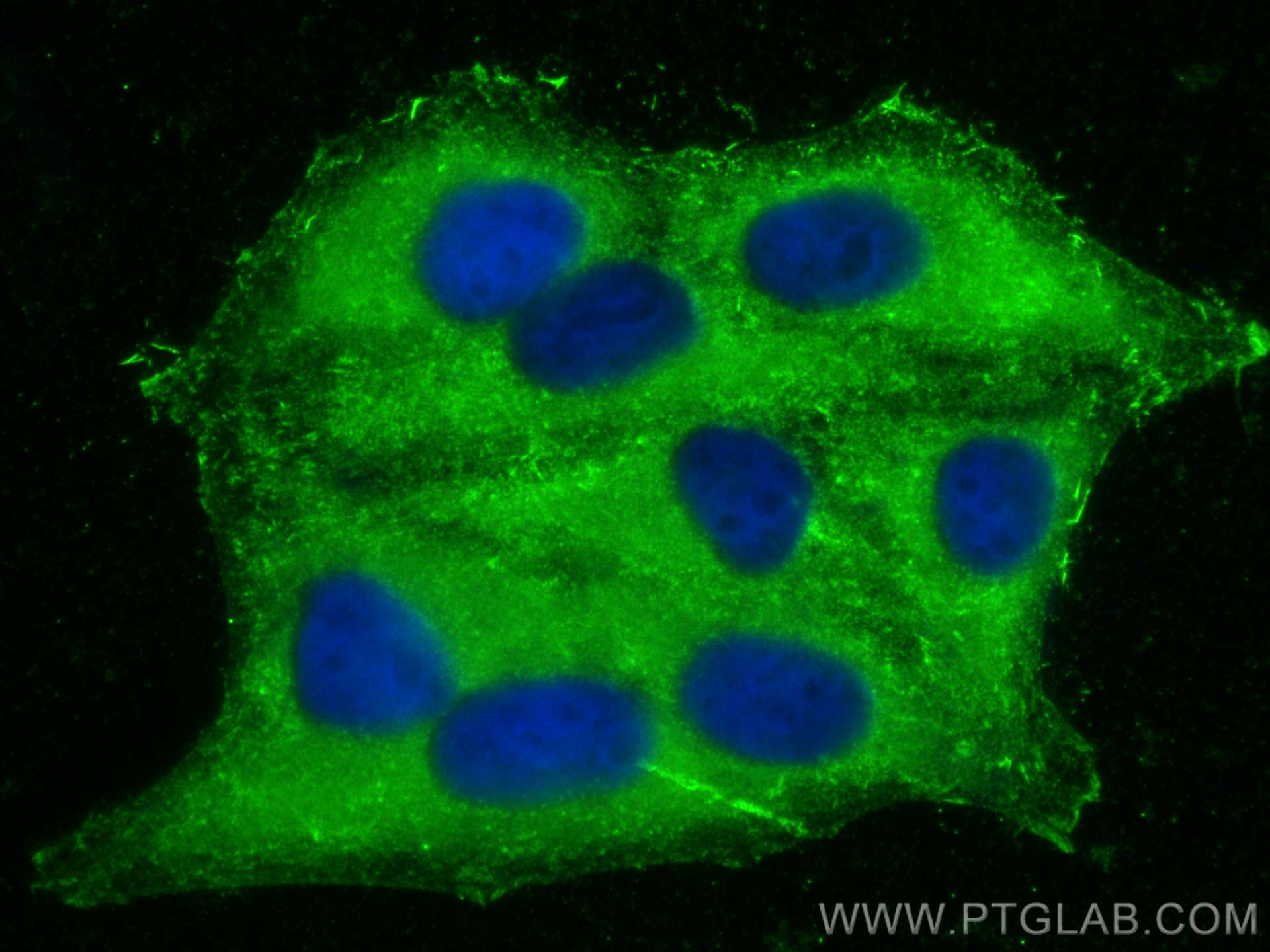 Immunofluorescence (IF) / fluorescent staining of HepG2 cells using ME1 Monoclonal antibody (68117-1-Ig)