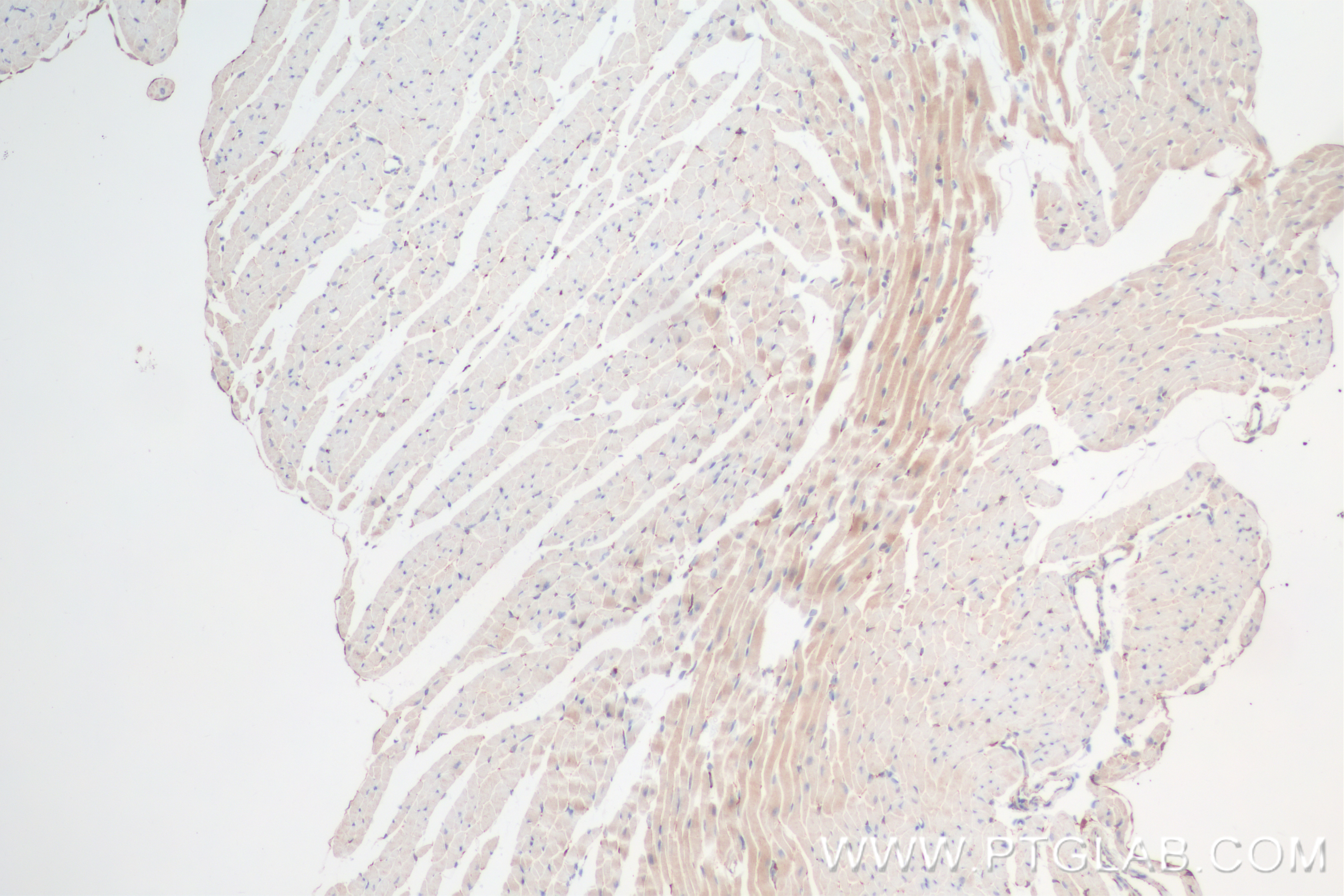 Immunohistochemistry (IHC) staining of mouse heart tissue using MECR Recombinant antibody (84729-4-RR)