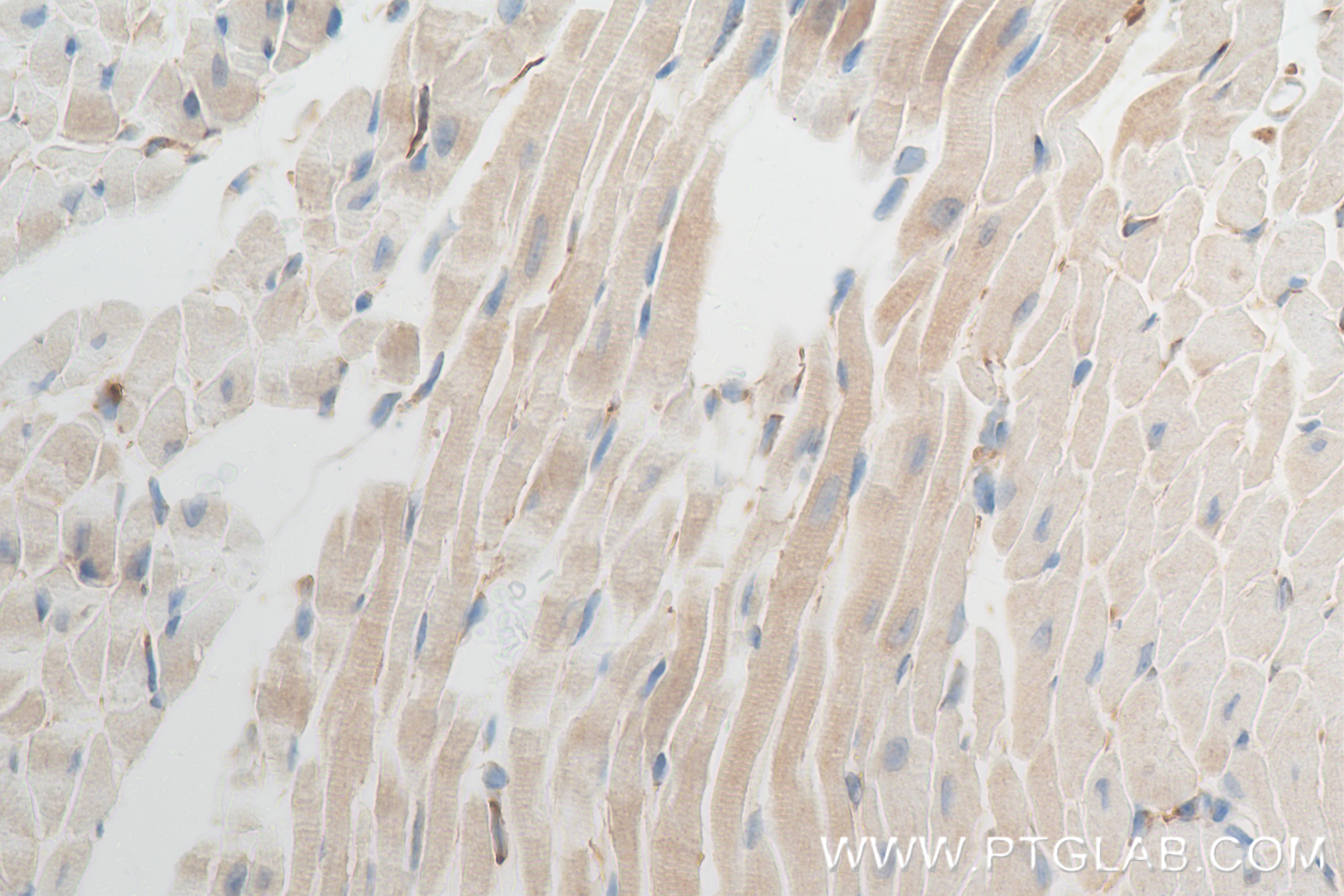 Immunohistochemistry (IHC) staining of mouse heart tissue using MECR Recombinant antibody (84729-4-RR)