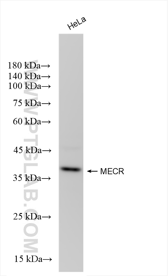 Western Blot (WB) analysis of HeLa cells using MECR Recombinant antibody (84729-4-RR)