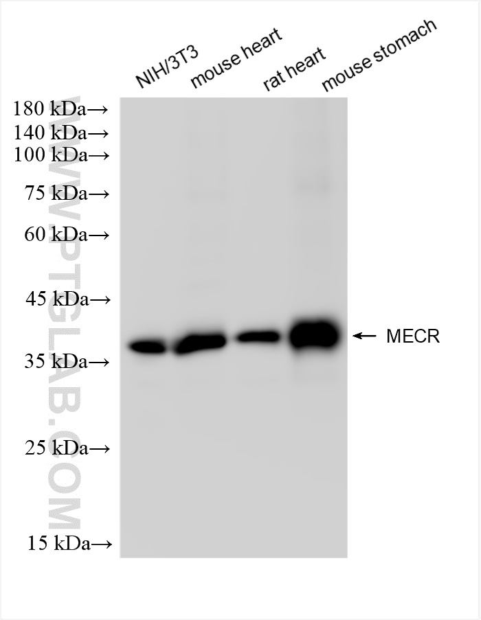 Western Blot (WB) analysis of various lysates using MECR Recombinant antibody (84729-4-RR)