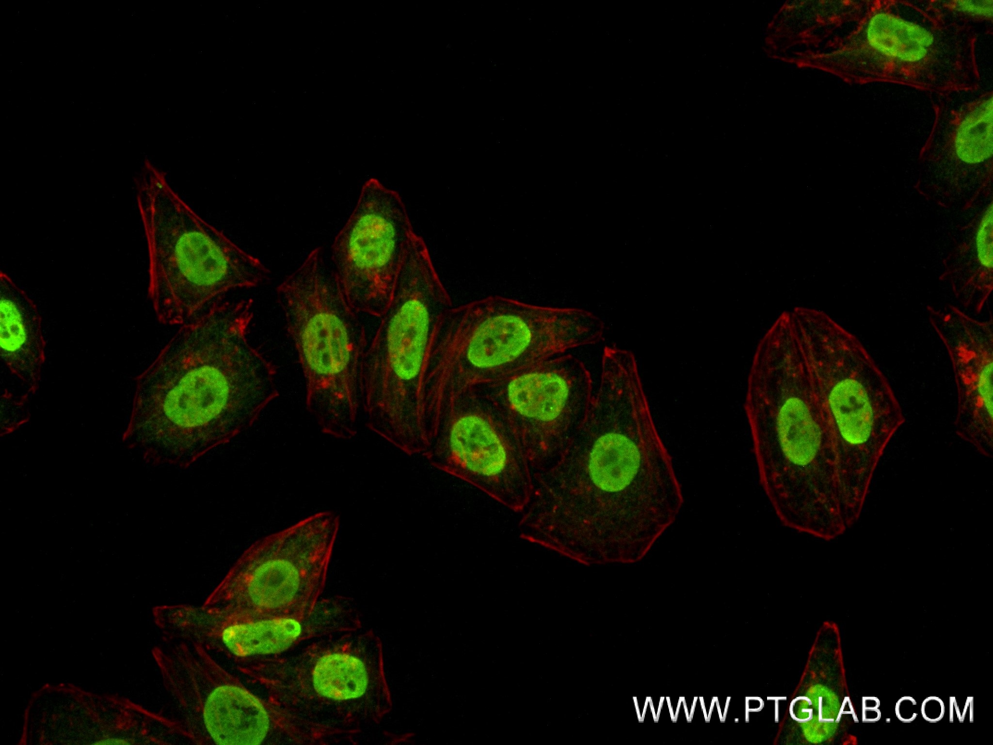 Immunofluorescence (IF) / fluorescent staining of HepG2 cells using MED12L Recombinant antibody (83540-1-RR)