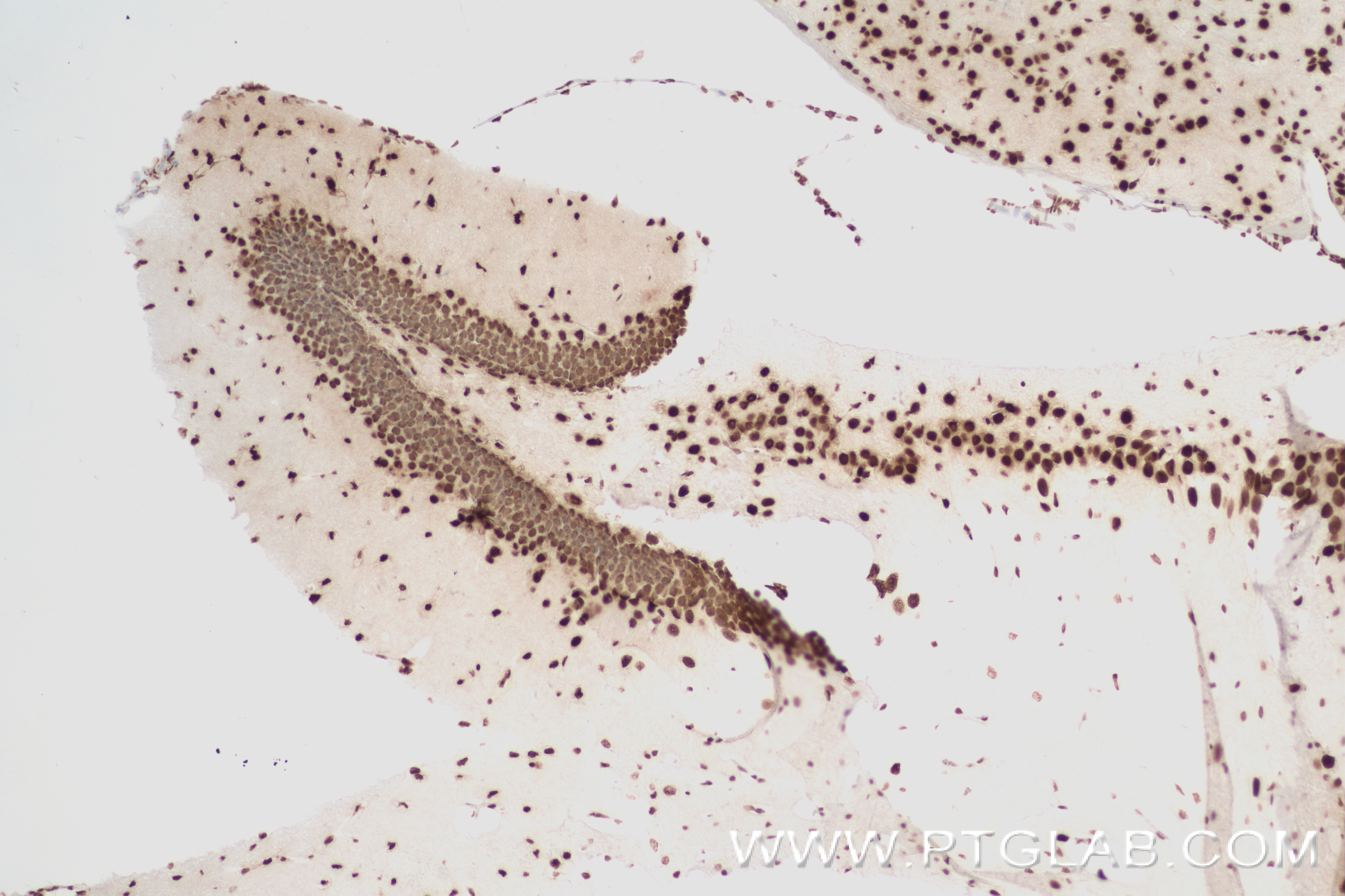 Immunohistochemistry (IHC) staining of mouse brain tissue using MED12L Recombinant antibody (83540-1-RR)