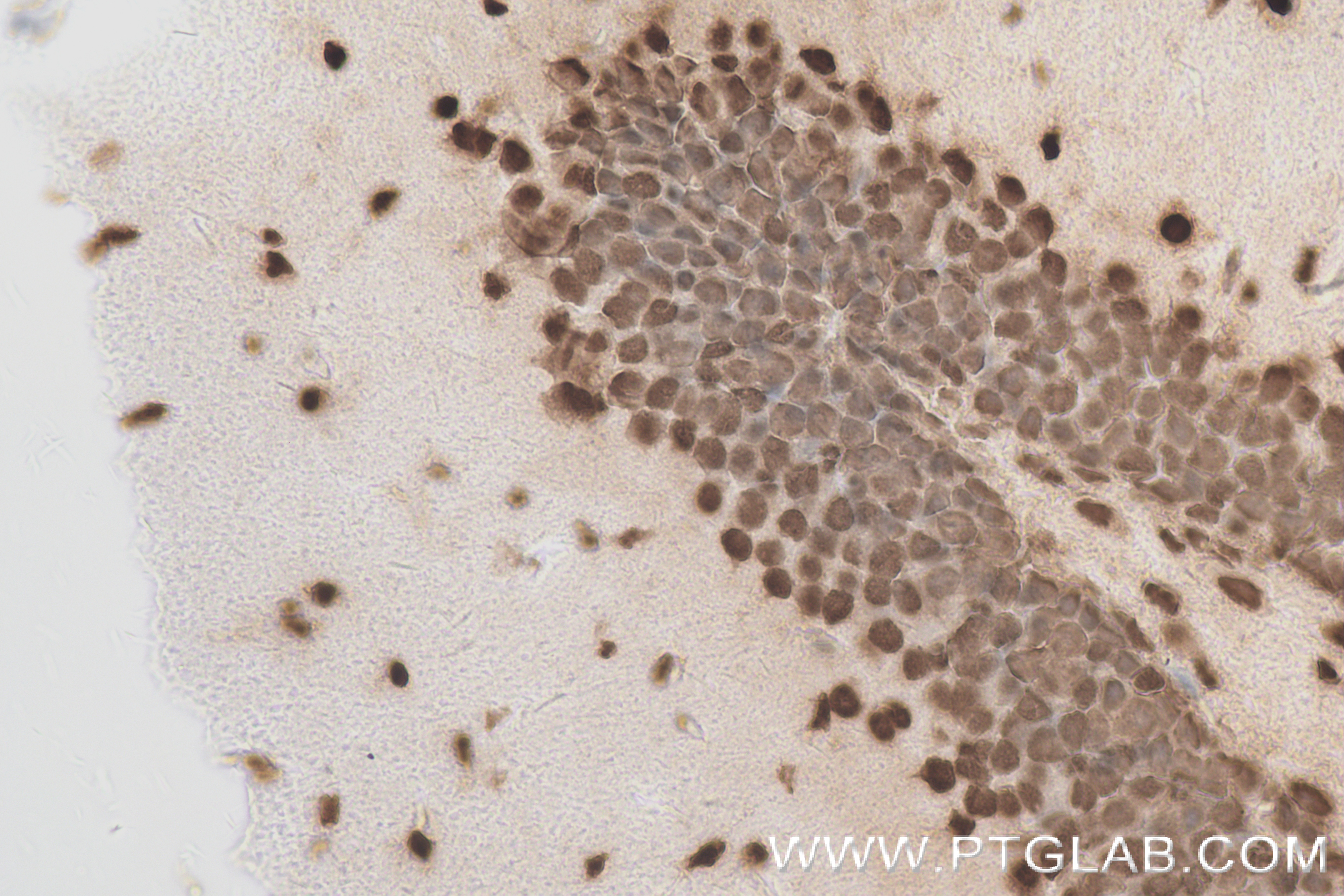 Immunohistochemistry (IHC) staining of mouse brain tissue using MED12L Recombinant antibody (83540-1-RR)