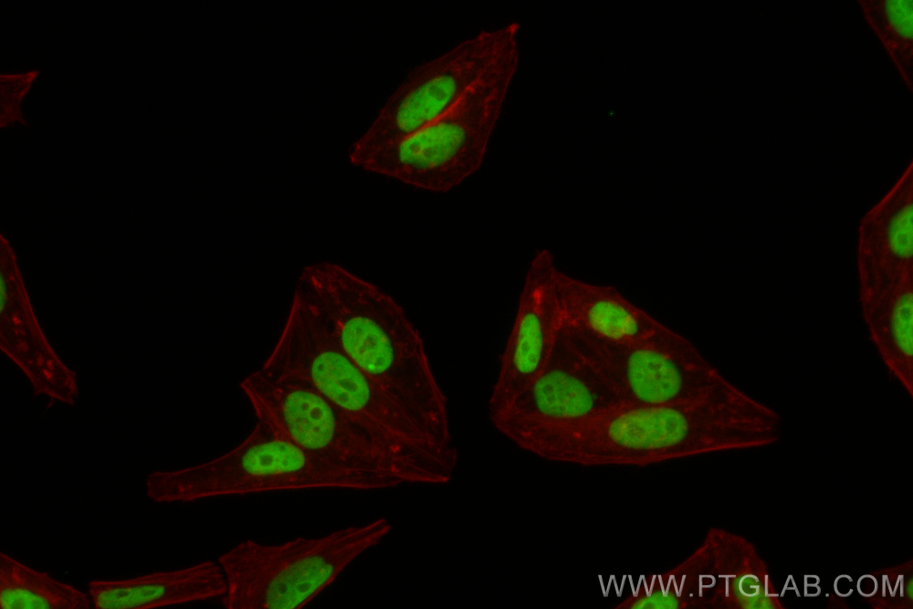 Immunofluorescence (IF) / fluorescent staining of HepG2 cells using CoraLite® Plus 488-conjugated MED12L Recombinant a (CL488-83540)