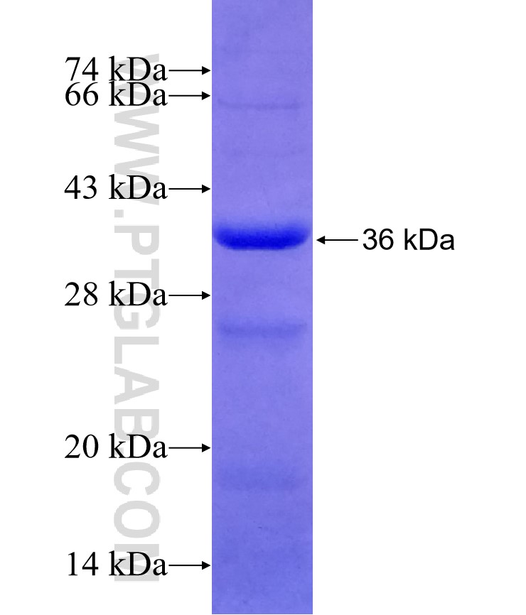 MED17 fusion protein Ag29038 SDS-PAGE