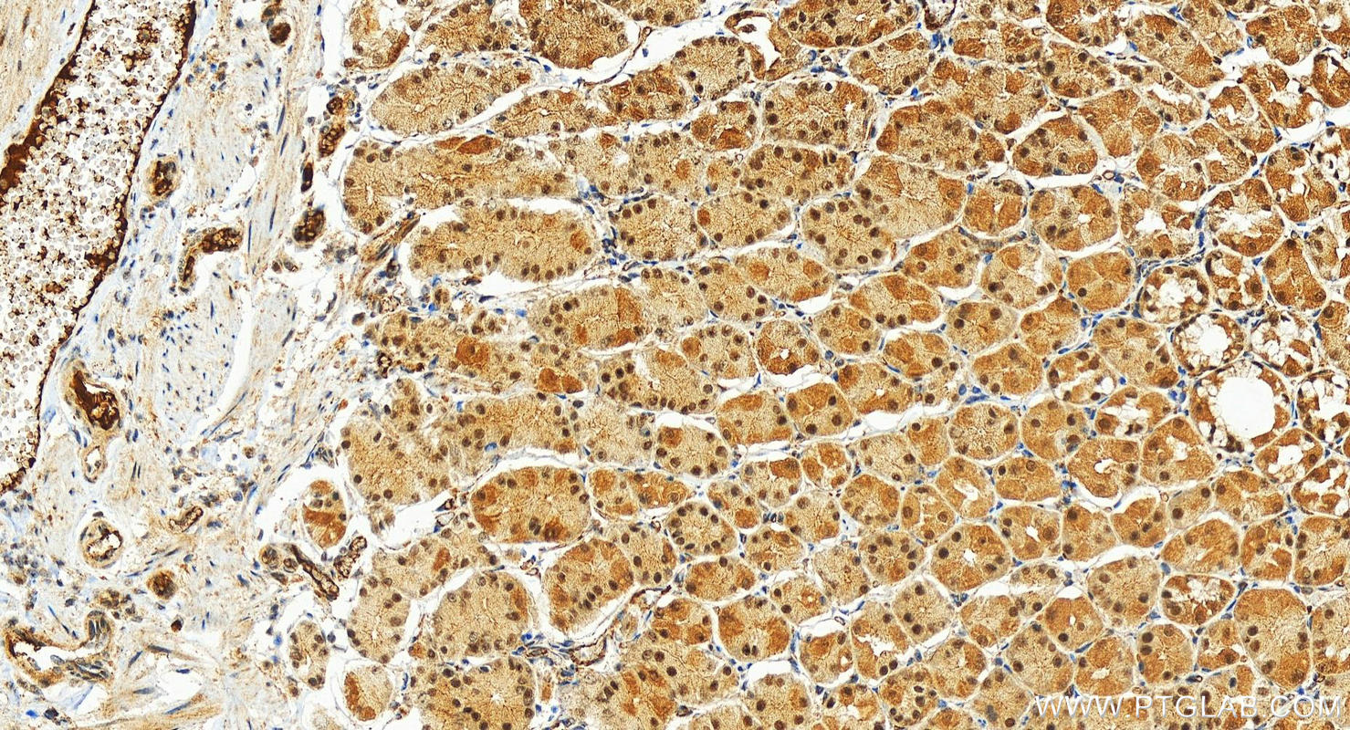 Immunohistochemistry (IHC) staining of human stomach tissue using MED23 Polyclonal antibody (27850-1-AP)