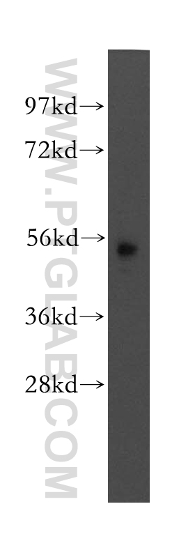 Western Blot (WB) analysis of mouse pancreas tissue using MEF2A Polyclonal antibody (12382-1-AP)
