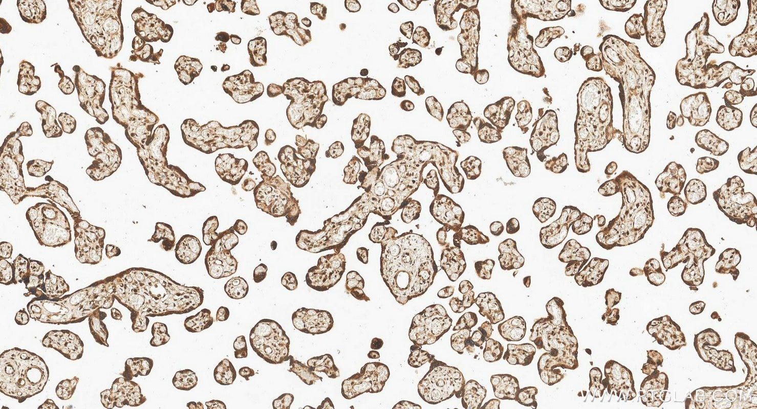 Immunohistochemistry (IHC) staining of human placenta tissue using MEF2C Polyclonal antibody (10056-1-AP)