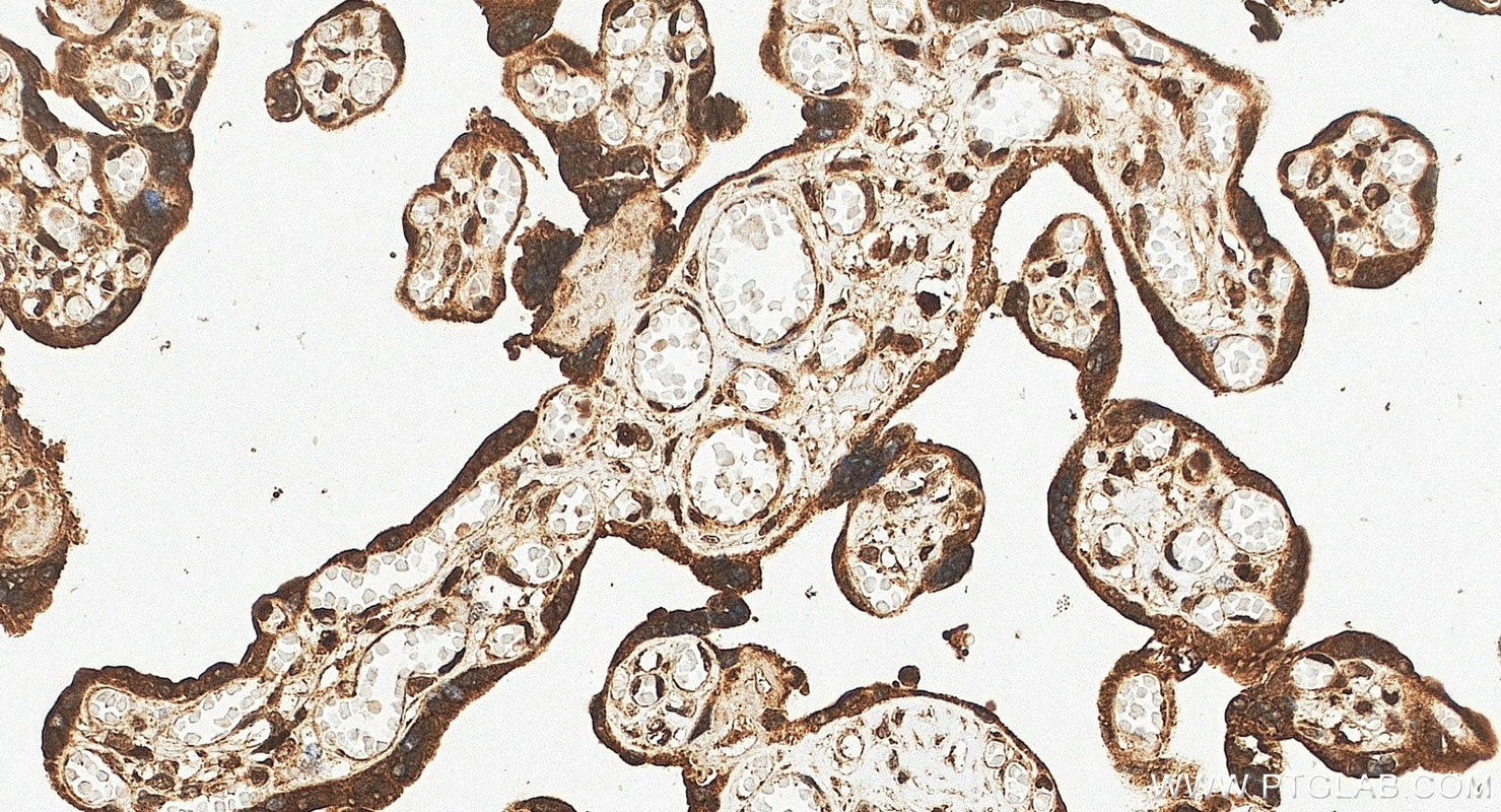 Immunohistochemistry (IHC) staining of human placenta tissue using MEF2C Polyclonal antibody (10056-1-AP)