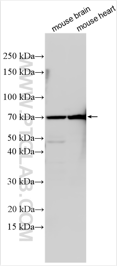 Western Blot (WB) analysis of various lysates using MEF2C Polyclonal antibody (10056-1-AP)
