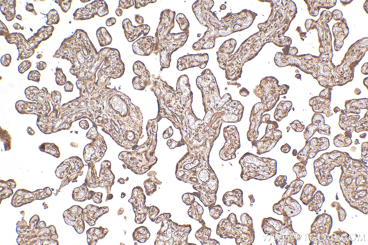 Immunohistochemistry (IHC) staining of human placenta tissue using MEF2C Polyclonal antibody (18290-1-AP)