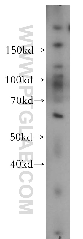 MEF2C-Specific