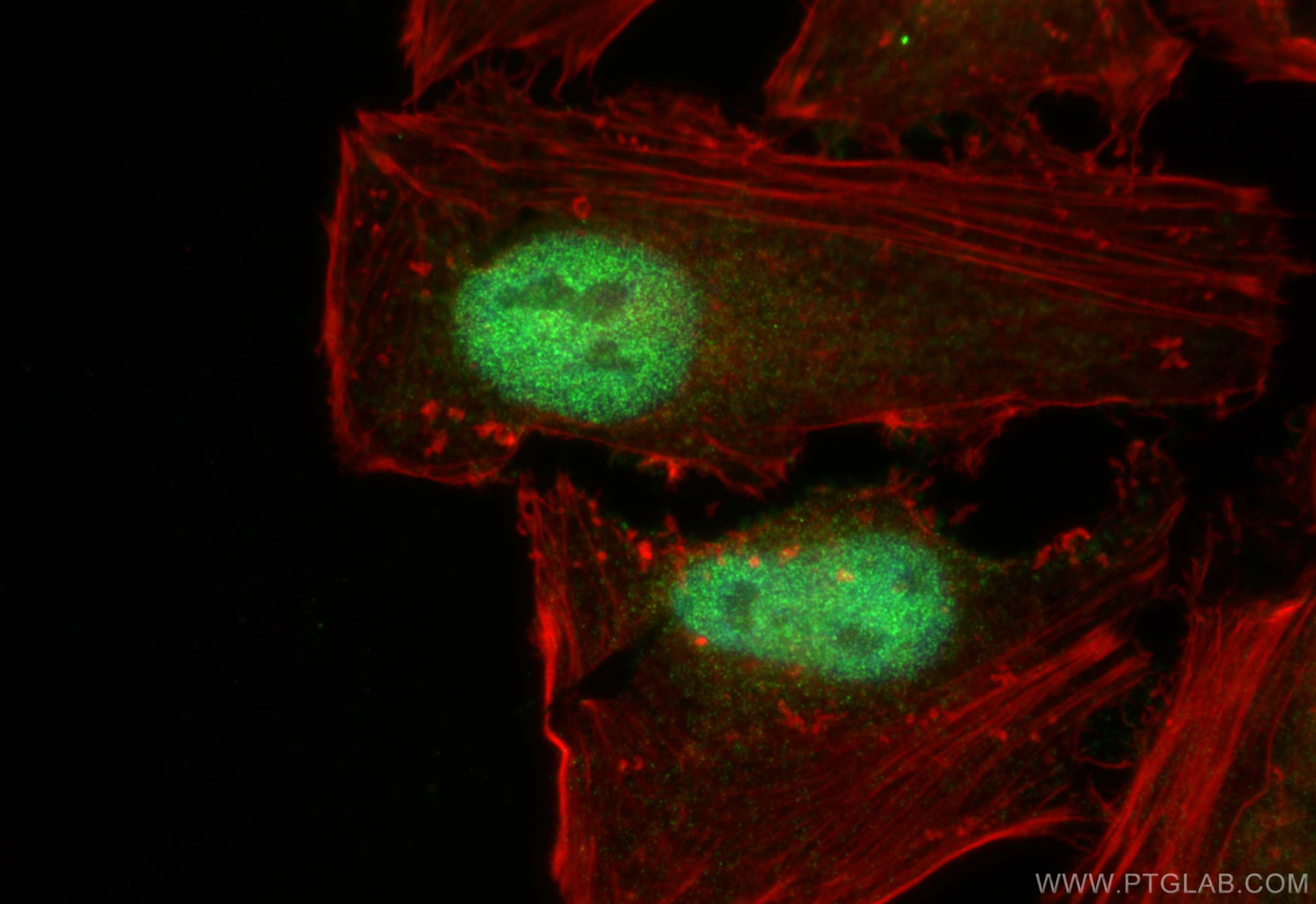 Immunofluorescence (IF) / fluorescent staining of HeLa cells using MEF2D Polyclonal antibody (14353-1-AP)