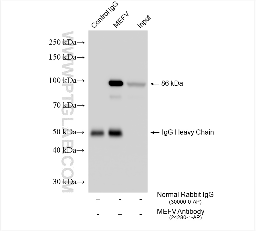 Immunoprecipitation (IP) experiment of THP-1 cells using MEFV Polyclonal antibody (24280-1-AP)