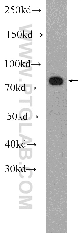 Western Blot (WB) analysis of human plasma using MEFV Polyclonal antibody (24280-1-AP)
