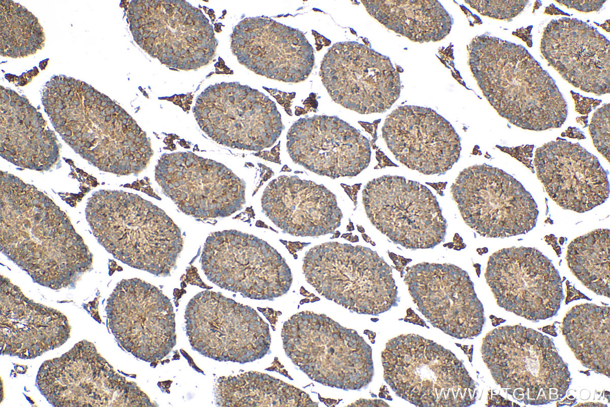 Immunohistochemistry (IHC) staining of mouse testis tissue using MEI4 Polyclonal antibody (29892-1-AP)