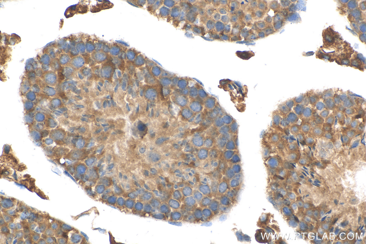 Immunohistochemistry (IHC) staining of mouse testis tissue using MEI4 Polyclonal antibody (29892-1-AP)