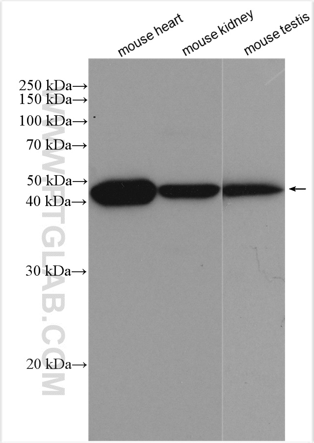 Western Blot (WB) analysis of various lysates using MEI4 Polyclonal antibody (29892-1-AP)