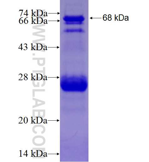 MEIS2 fusion protein Ag2096 SDS-PAGE
