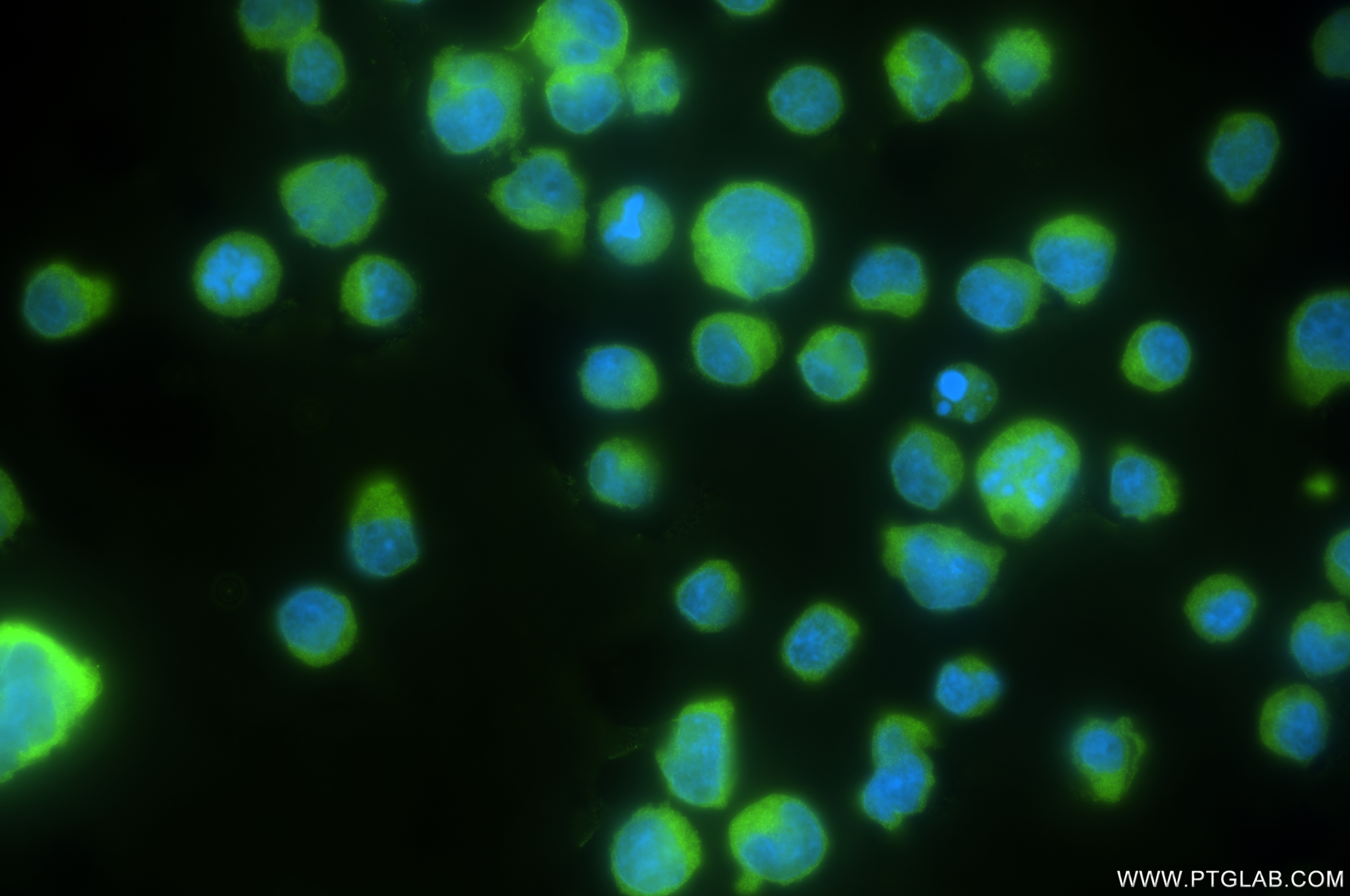 Immunofluorescence (IF) / fluorescent staining of Jurkat cells using MEK1/2 Recombinant antibody (84967-1-RR)