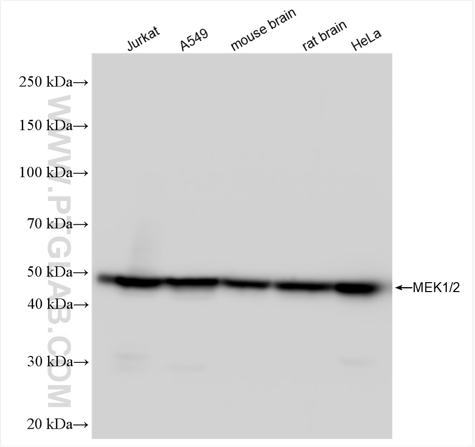 Western Blot (WB) analysis of various lysates using MEK1/2 Recombinant antibody (84967-1-RR)