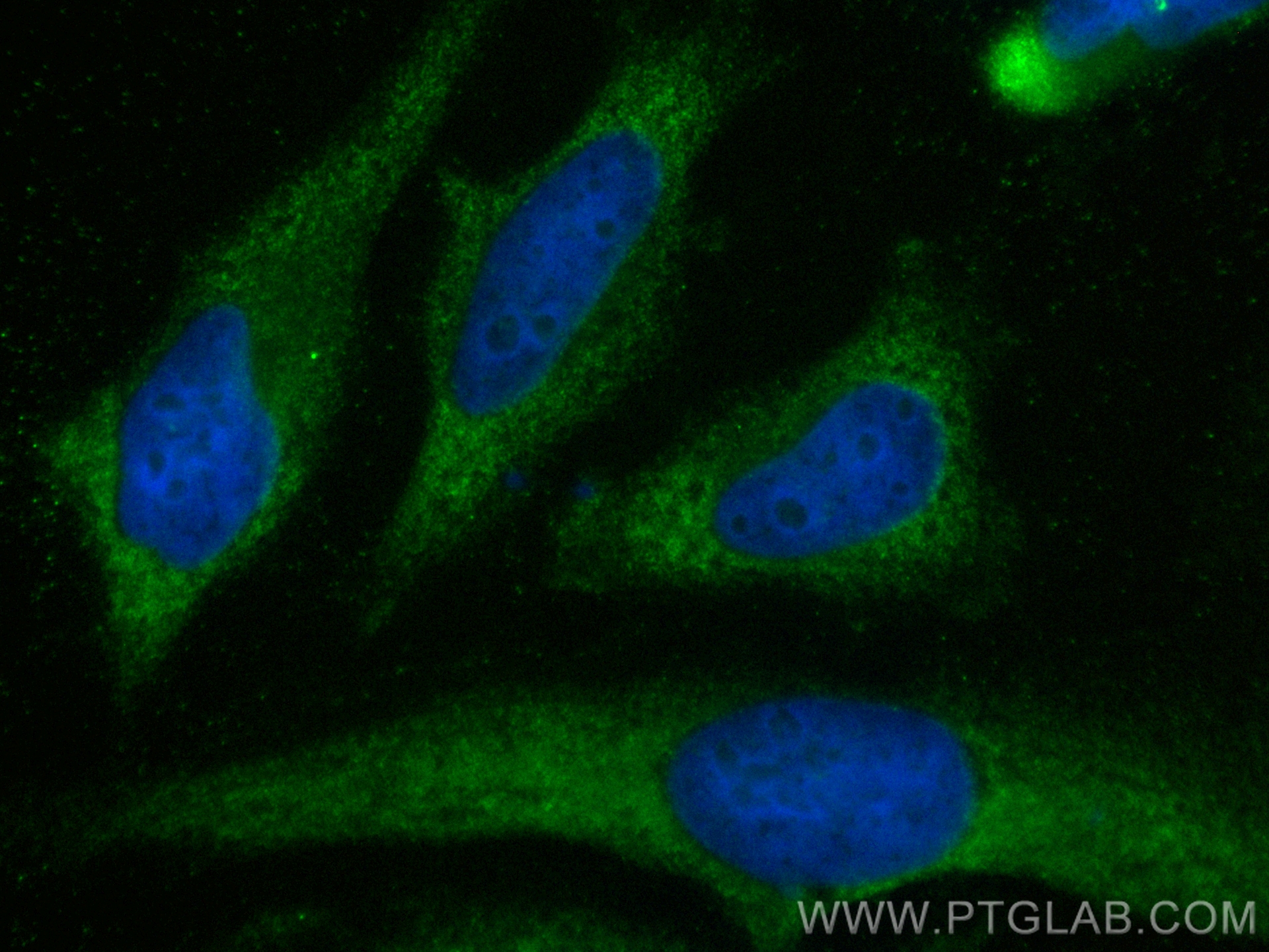 Immunofluorescence (IF) / fluorescent staining of HeLa cells using CoraLite® Plus 488-conjugated MEK1/2 Polyclonal an (CL488-11049)