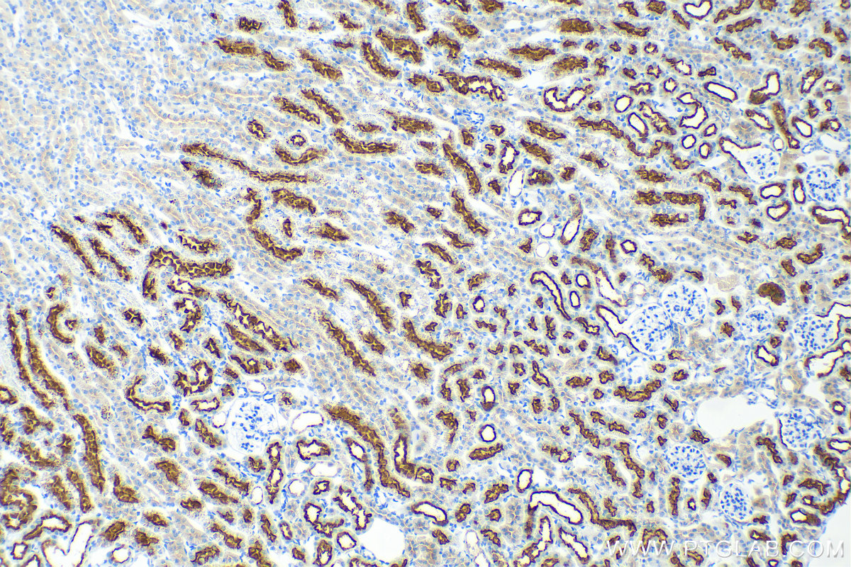 Immunohistochemistry (IHC) staining of mouse kidney tissue using MELK Recombinant antibody (82893-2-RR)