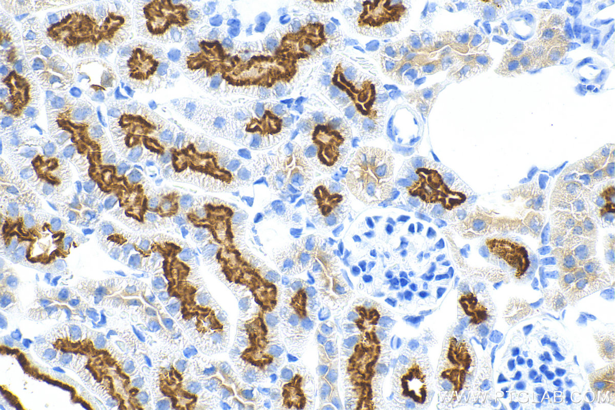 Immunohistochemistry (IHC) staining of mouse kidney tissue using MELK Recombinant antibody (82893-2-RR)