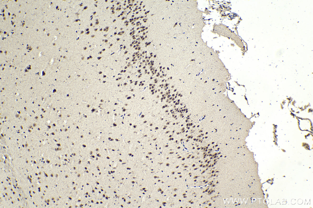 Immunohistochemistry (IHC) staining of mouse brain tissue using MEN1 Monoclonal antibody (68473-1-Ig)