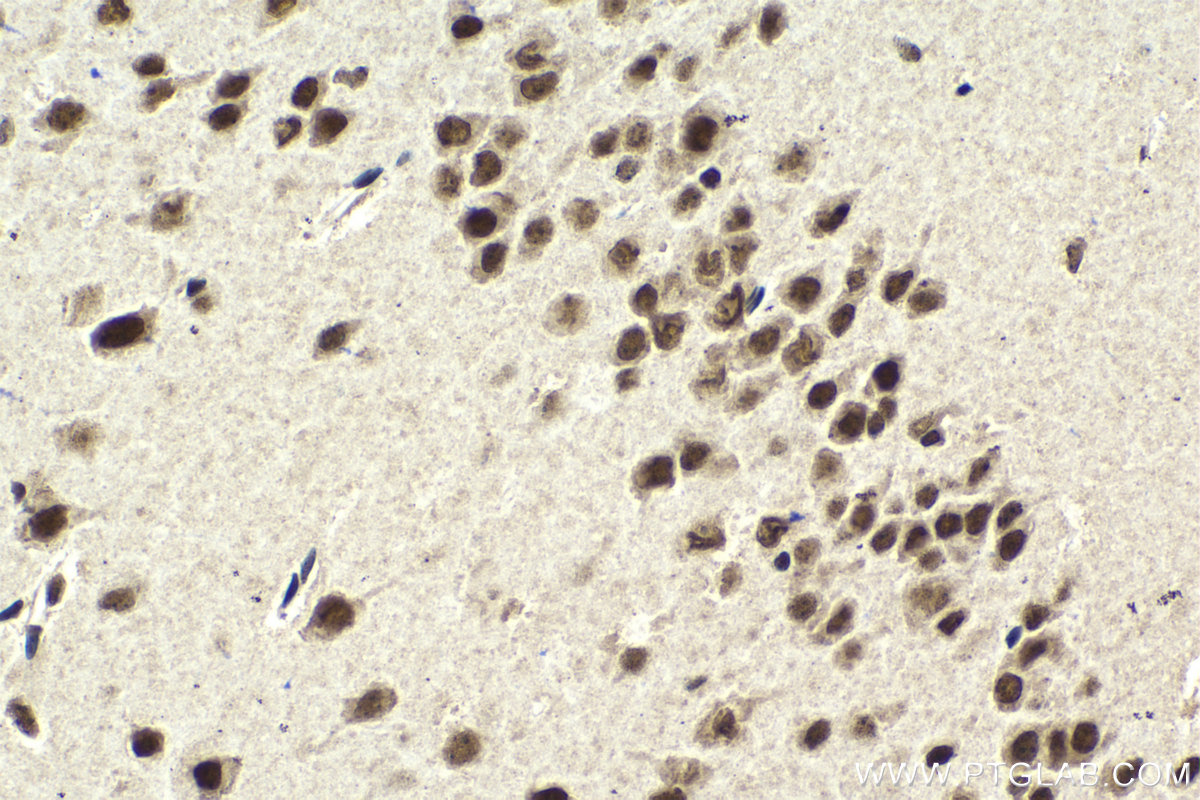 Immunohistochemistry (IHC) staining of mouse brain tissue using MEN1 Monoclonal antibody (68473-1-Ig)