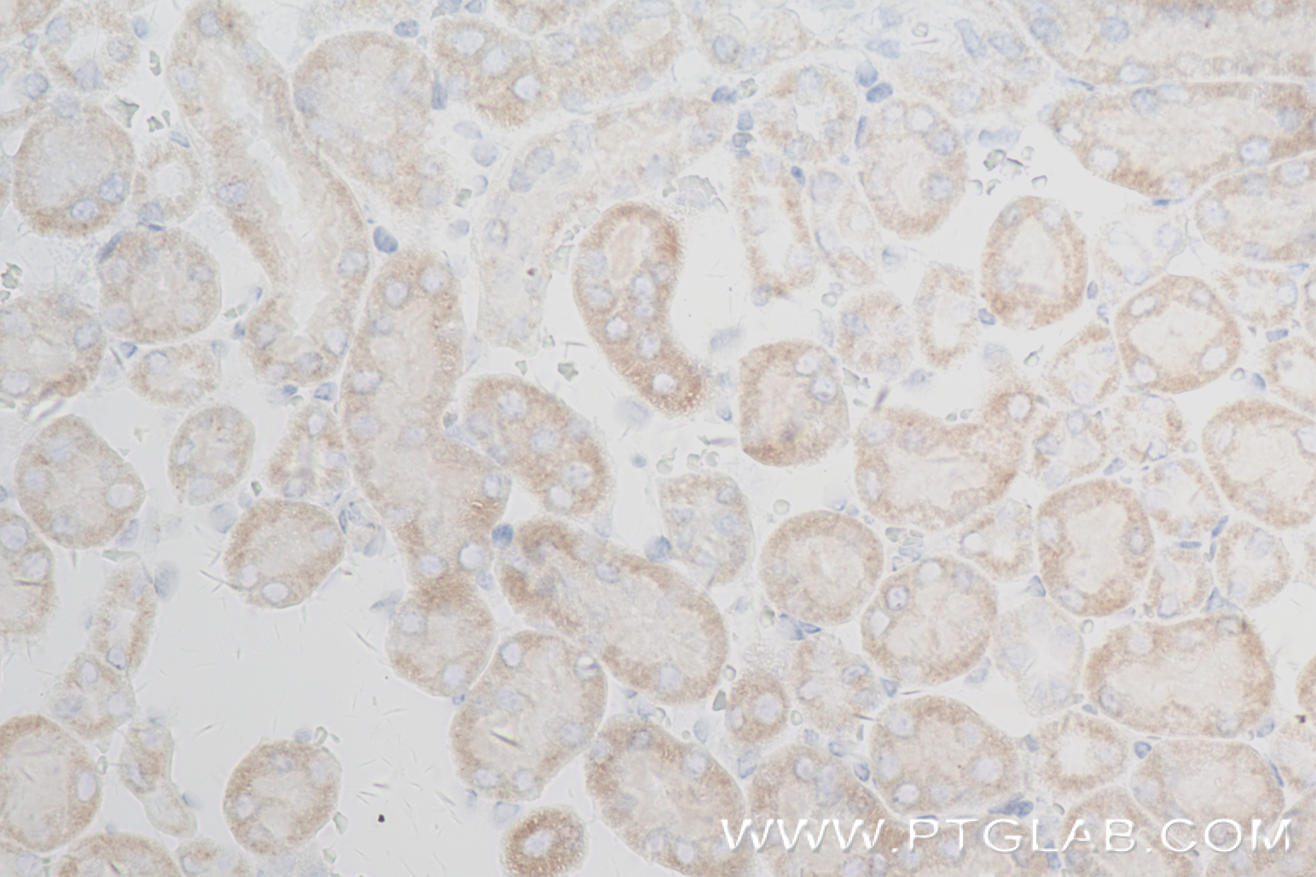 Immunohistochemistry (IHC) staining of mouse kidney tissue using MERTK Recombinant antibody (84156-2-RR)