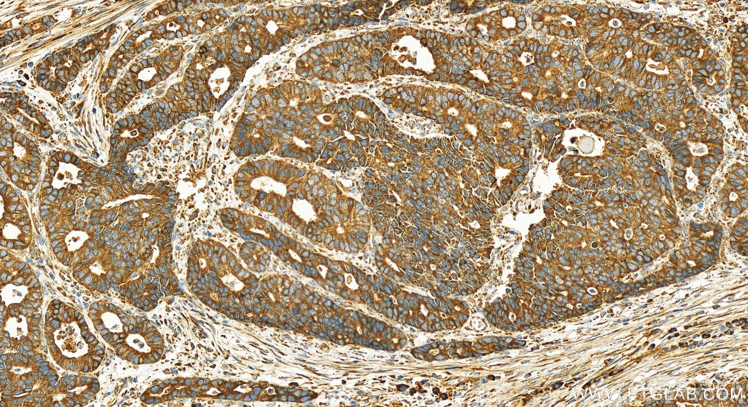 Immunohistochemistry (IHC) staining of human stomach tissue using MESDC2 Polyclonal antibody (10958-1-AP)