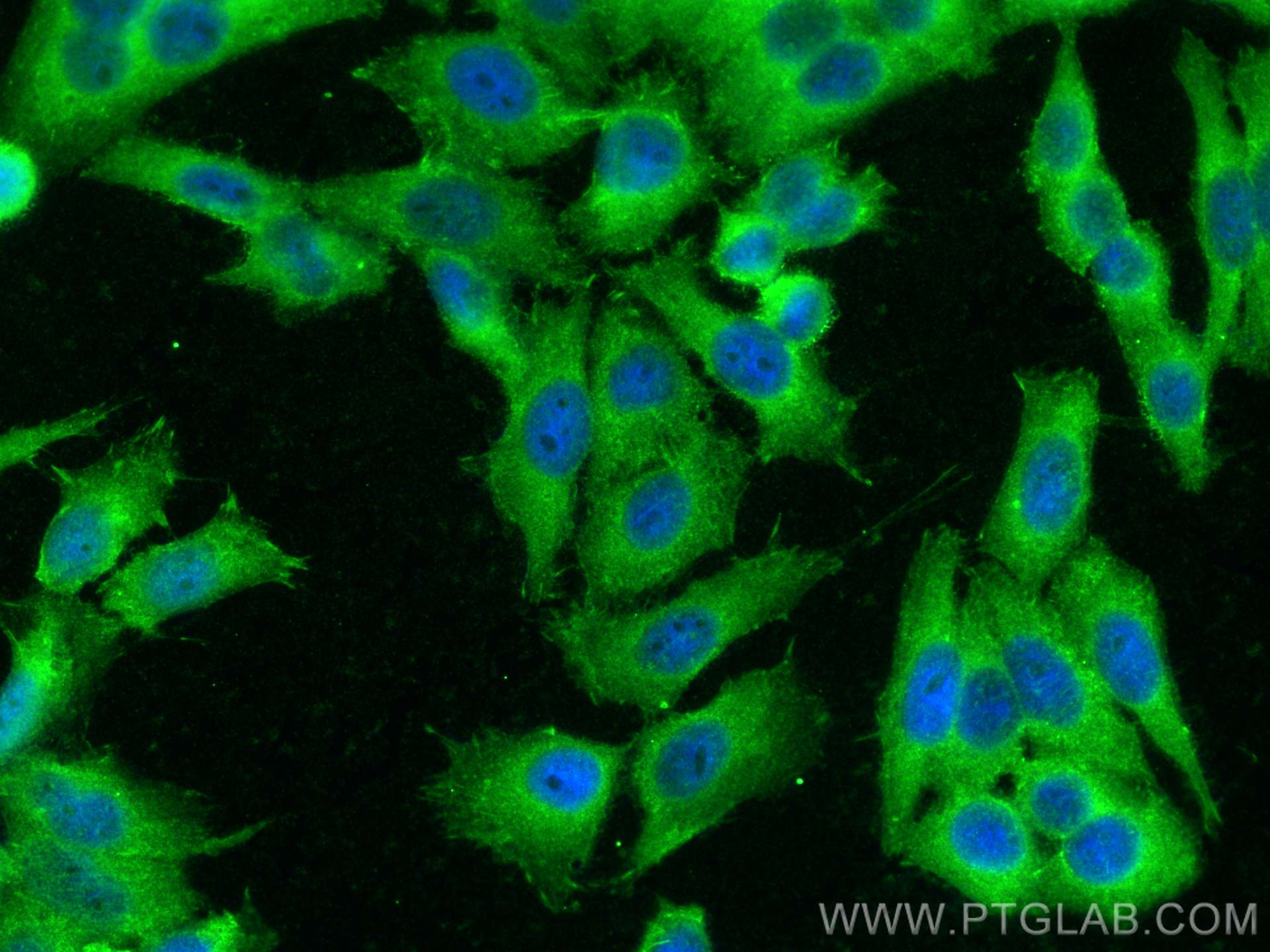 Immunofluorescence (IF) / fluorescent staining of HepG2 cells using c-Met (Cytoplasmic) Polyclonal antibody (25869-1-AP)