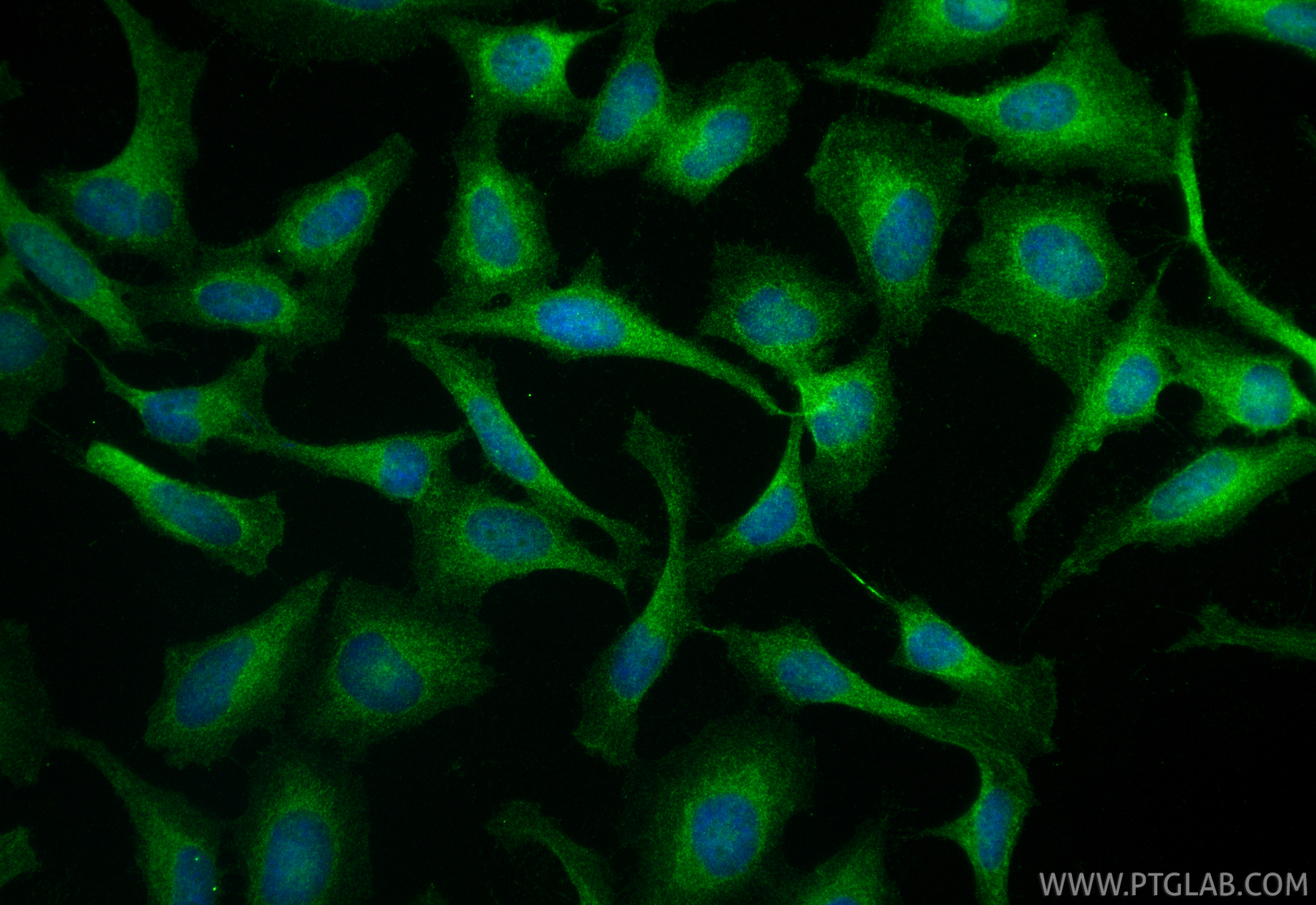 Immunofluorescence (IF) / fluorescent staining of HeLa cells using c-Met (Cytoplasmic) Polyclonal antibody (25869-1-AP)
