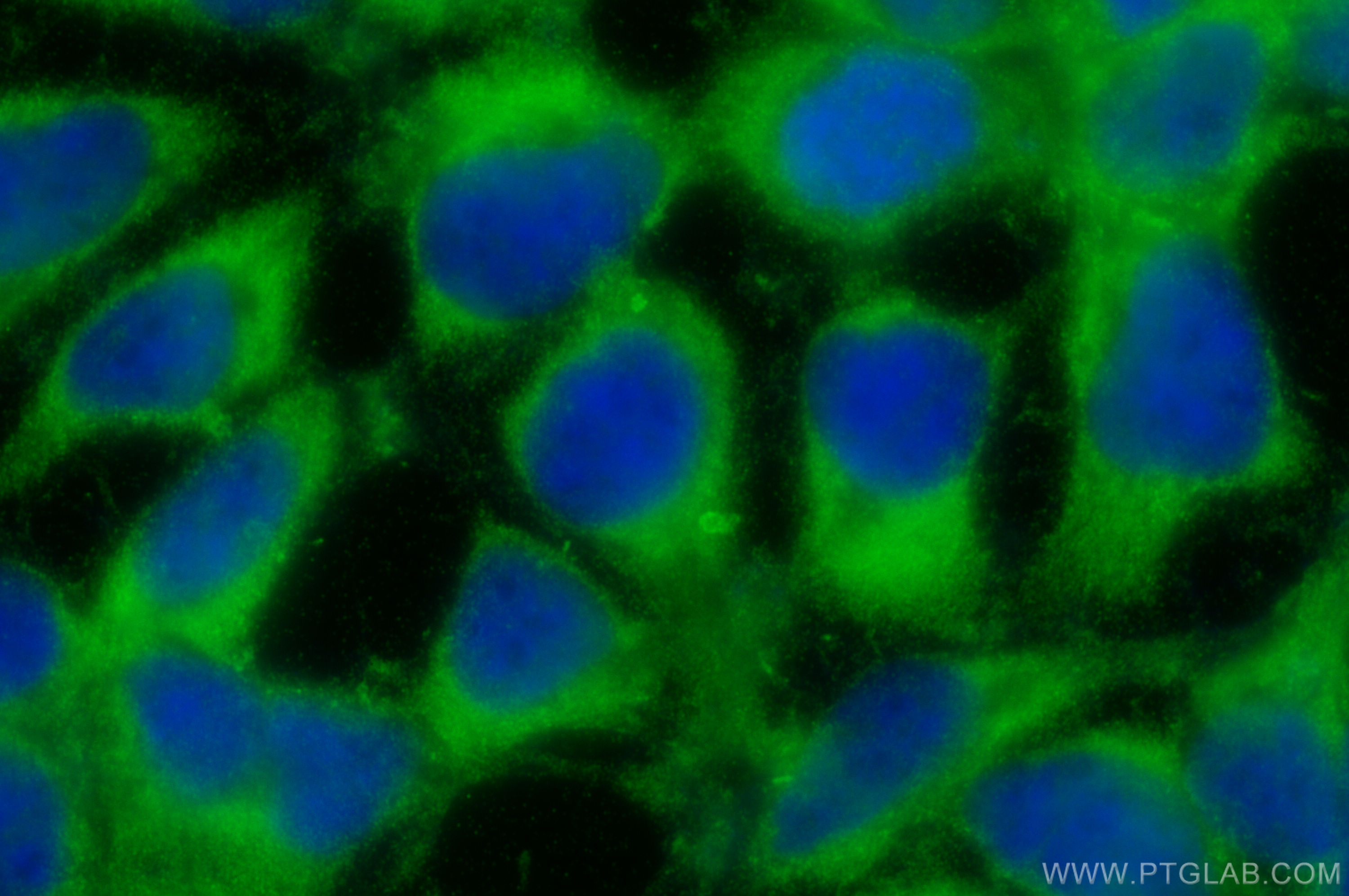 Immunofluorescence (IF) / fluorescent staining of HEK-293 cells using METAP1 Polyclonal antibody (28702-1-AP)