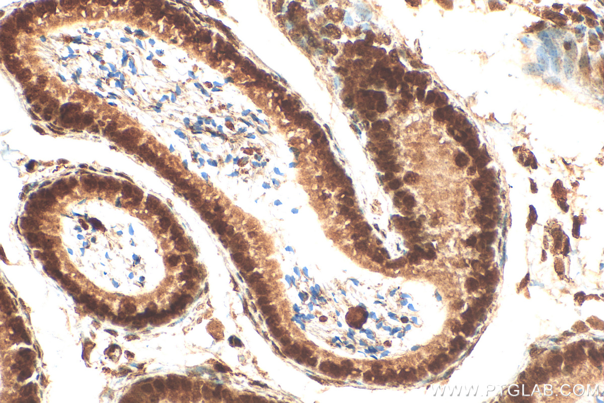 Immunohistochemistry (IHC) staining of mouse testis tissue using METTL16 Polyclonal antibody (19924-1-AP)