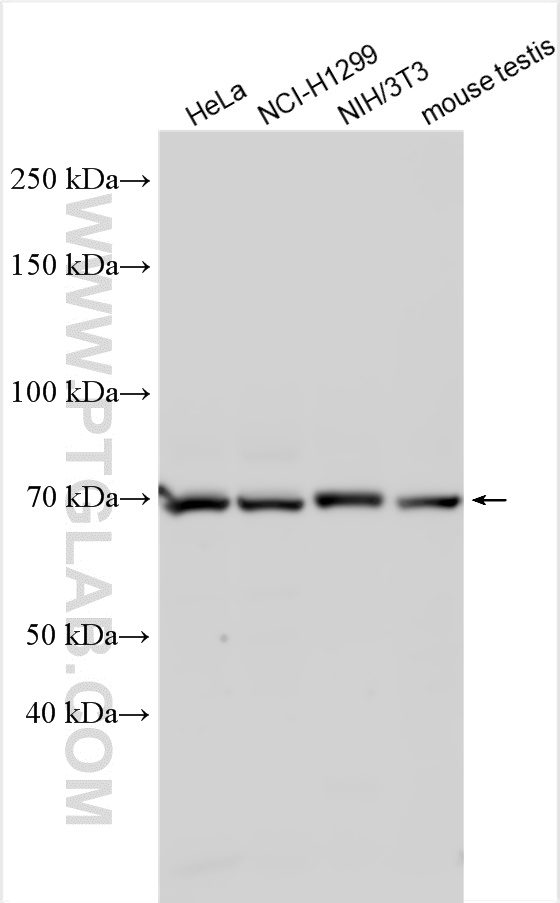 Western Blot (WB) analysis of various lysates using METTL16 Polyclonal antibody (19924-1-AP)