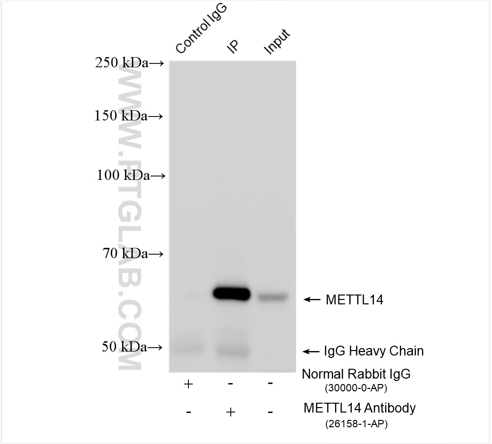 Immunoprecipitation (IP) experiment of A549 cells using METTL14 Polyclonal antibody (26158-1-AP)