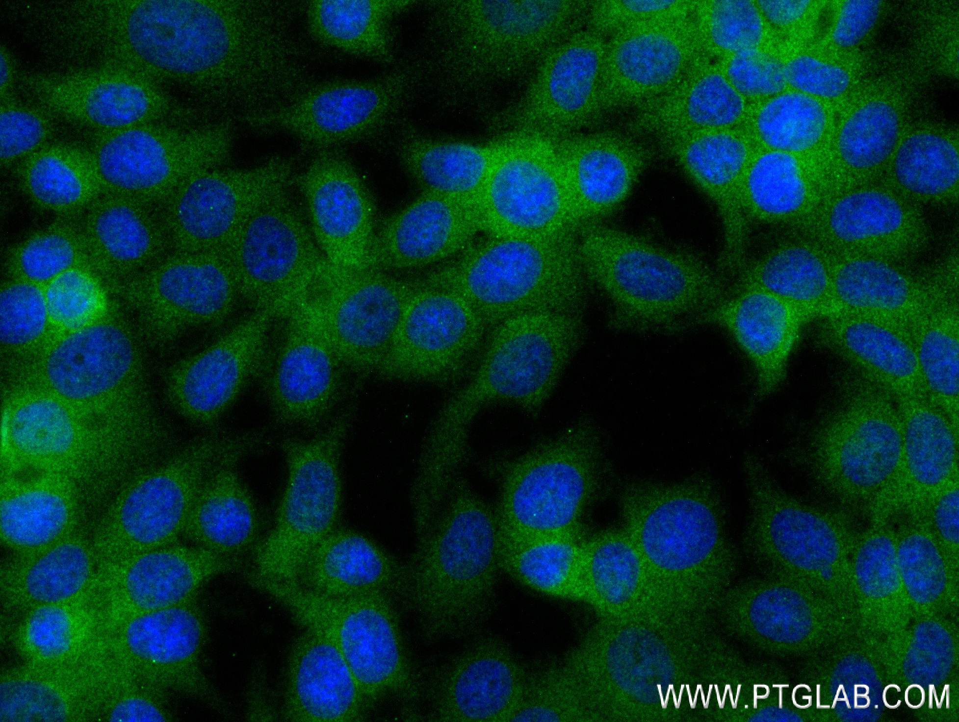 Immunofluorescence (IF) / fluorescent staining of MCF-7 cells using METTL2 Recombinant antibody (84257-1-RR)