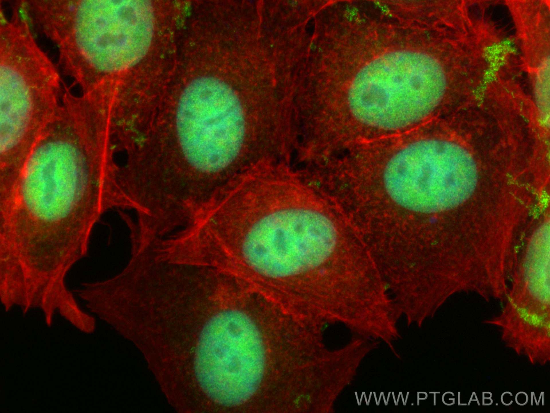 Immunofluorescence (IF) / fluorescent staining of MCF-7 cells using METTL3 Polyclonal antibody (15073-1-AP)