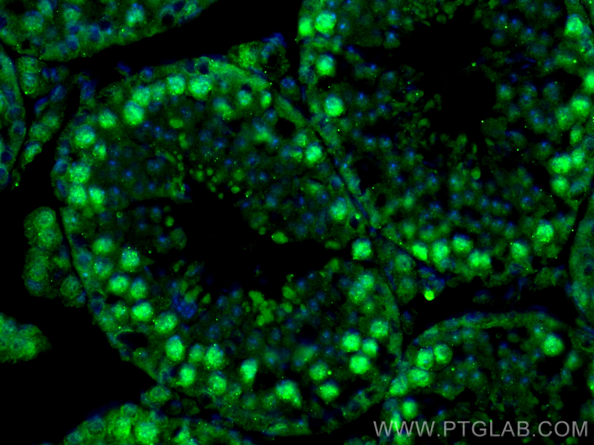 Immunofluorescence (IF) / fluorescent staining of Mouse testis tissue using METTL3 Recombinant antibody (80323-1-RR)