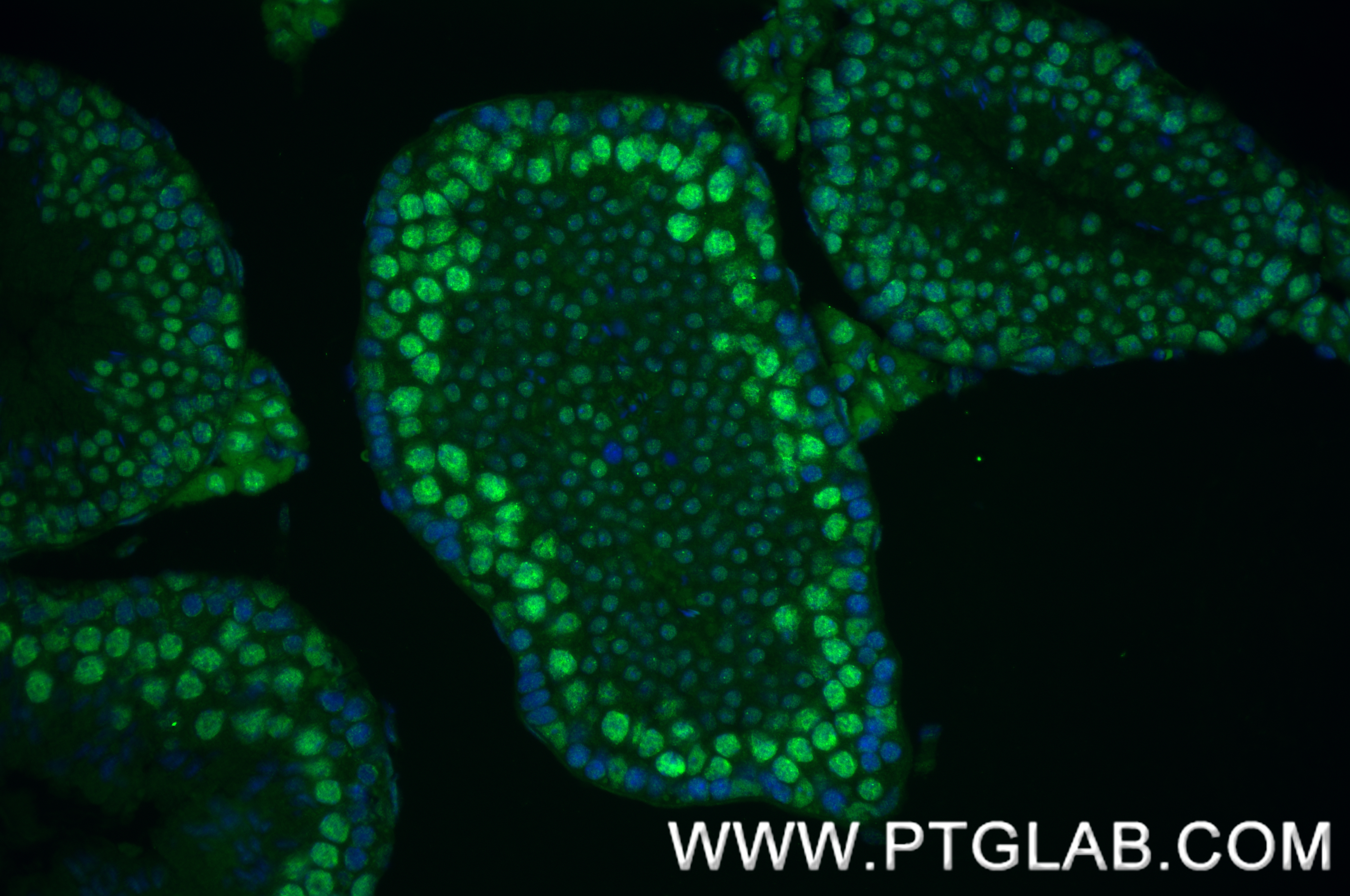 Immunofluorescence (IF) / fluorescent staining of mouse testis tissue using METTL3 Recombinant antibody (80323-1-RR)