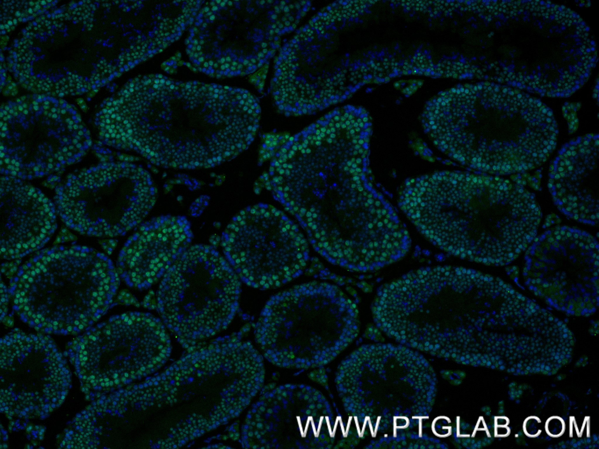 Immunofluorescence (IF) / fluorescent staining of mouse testis tissue using METTL3 Recombinant antibody (80323-1-RR)