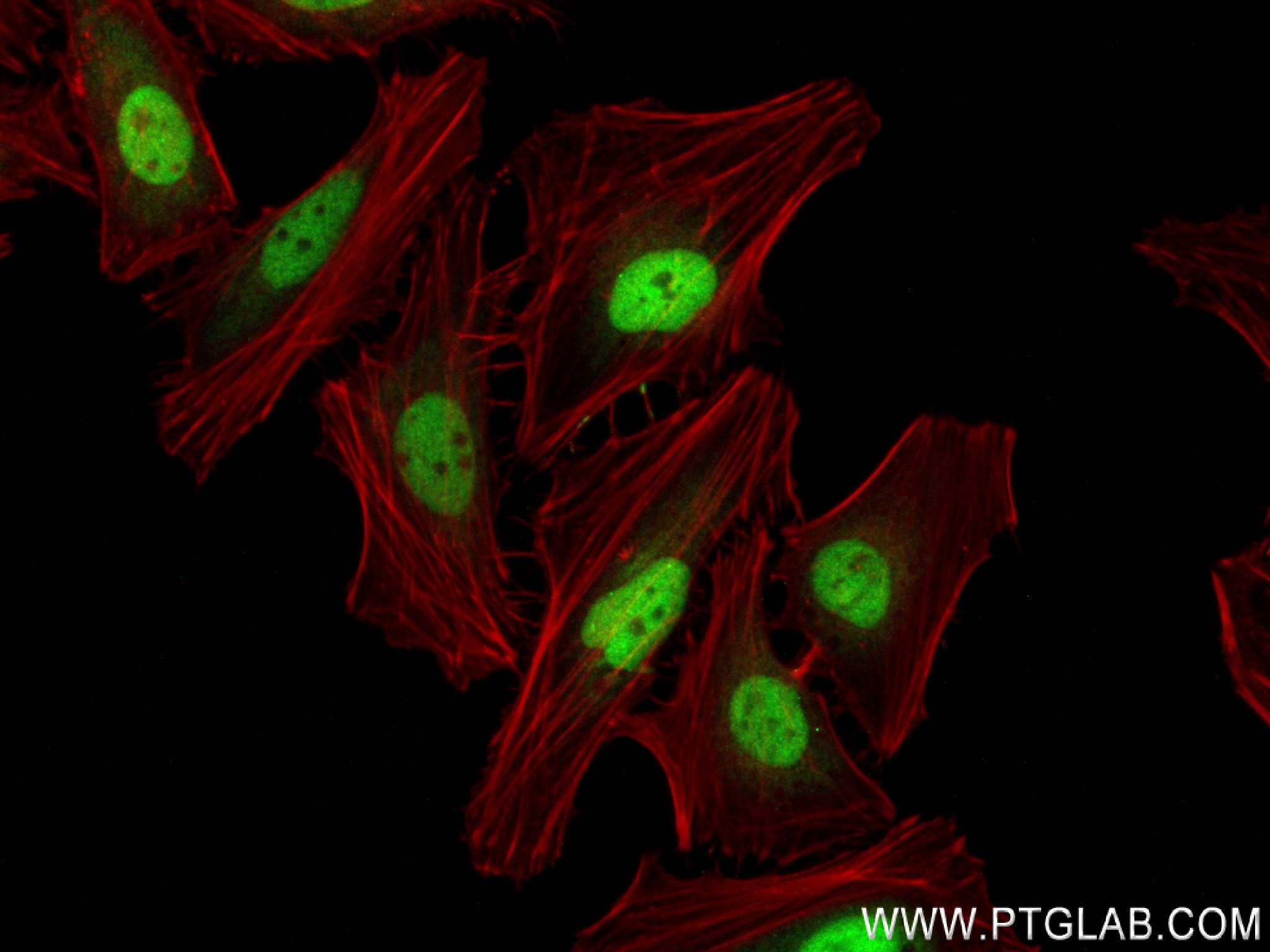 Immunofluorescence (IF) / fluorescent staining of HeLa cells using METTL6 Recombinant antibody (84209-5-RR)