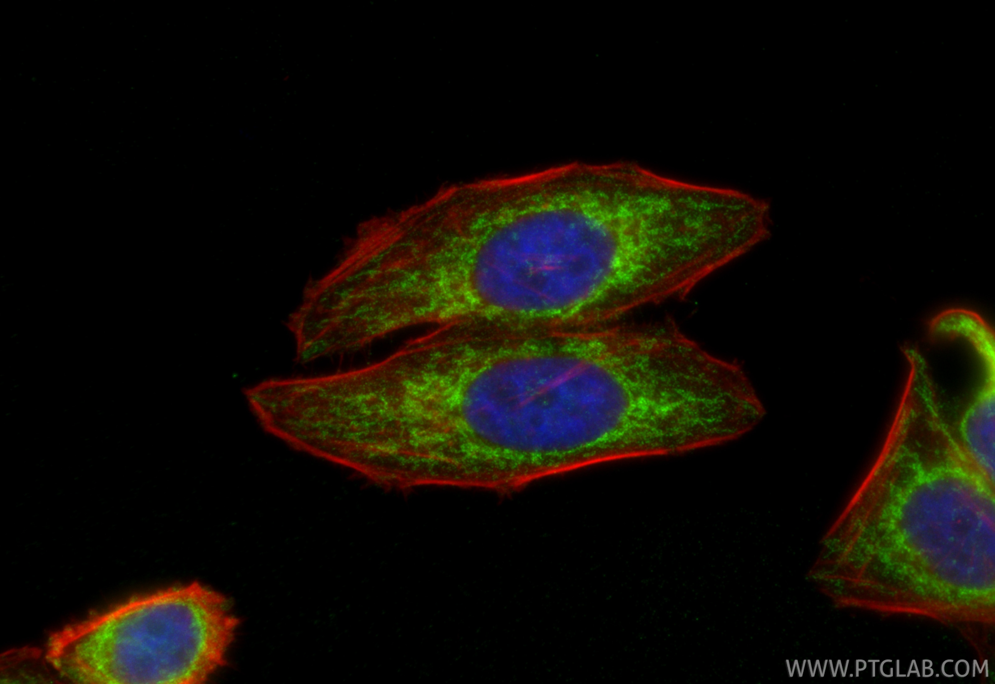 Immunofluorescence (IF) / fluorescent staining of HepG2 cells using MFN1 Monoclonal antibody (66776-1-Ig)