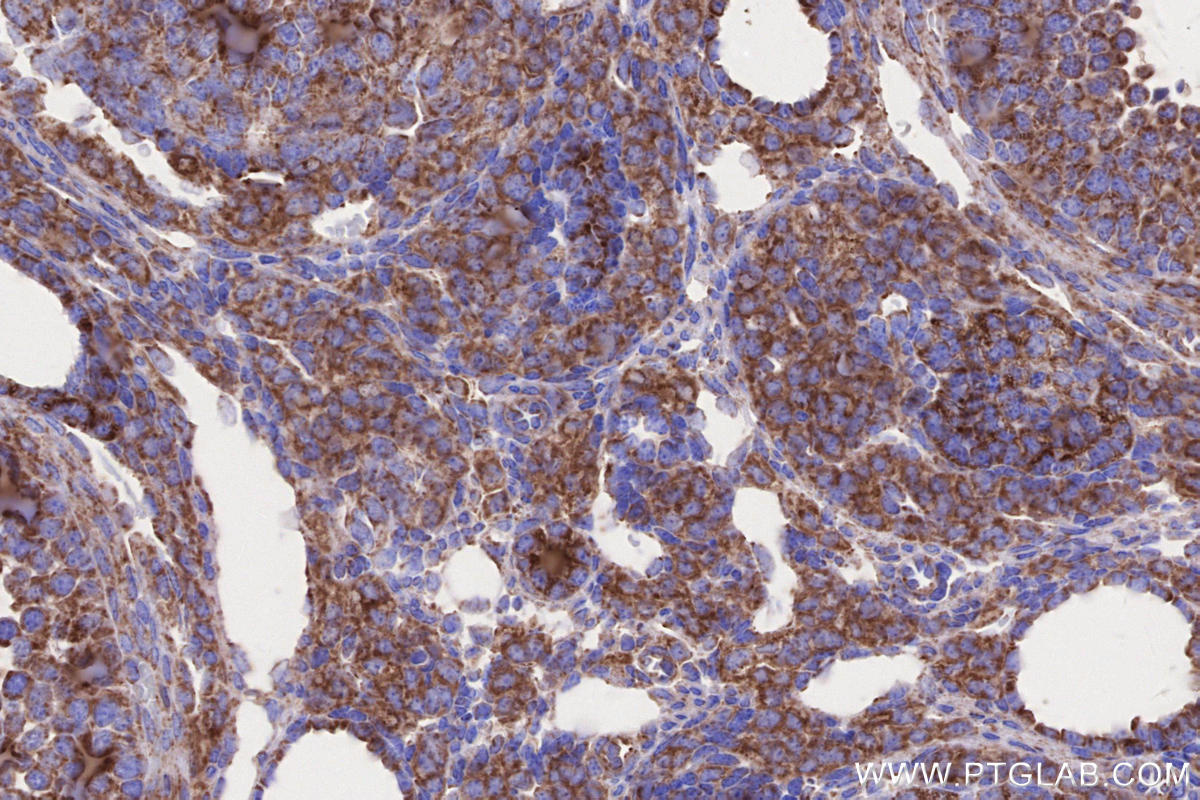 Immunohistochemistry (IHC) staining of mouse ovary tissue using MFN1 Monoclonal antibody (66776-1-Ig)